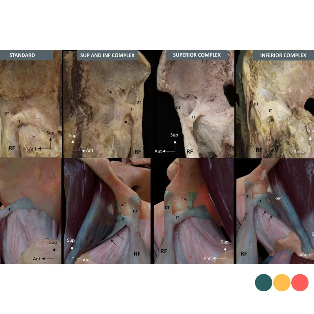 Rectus femoris