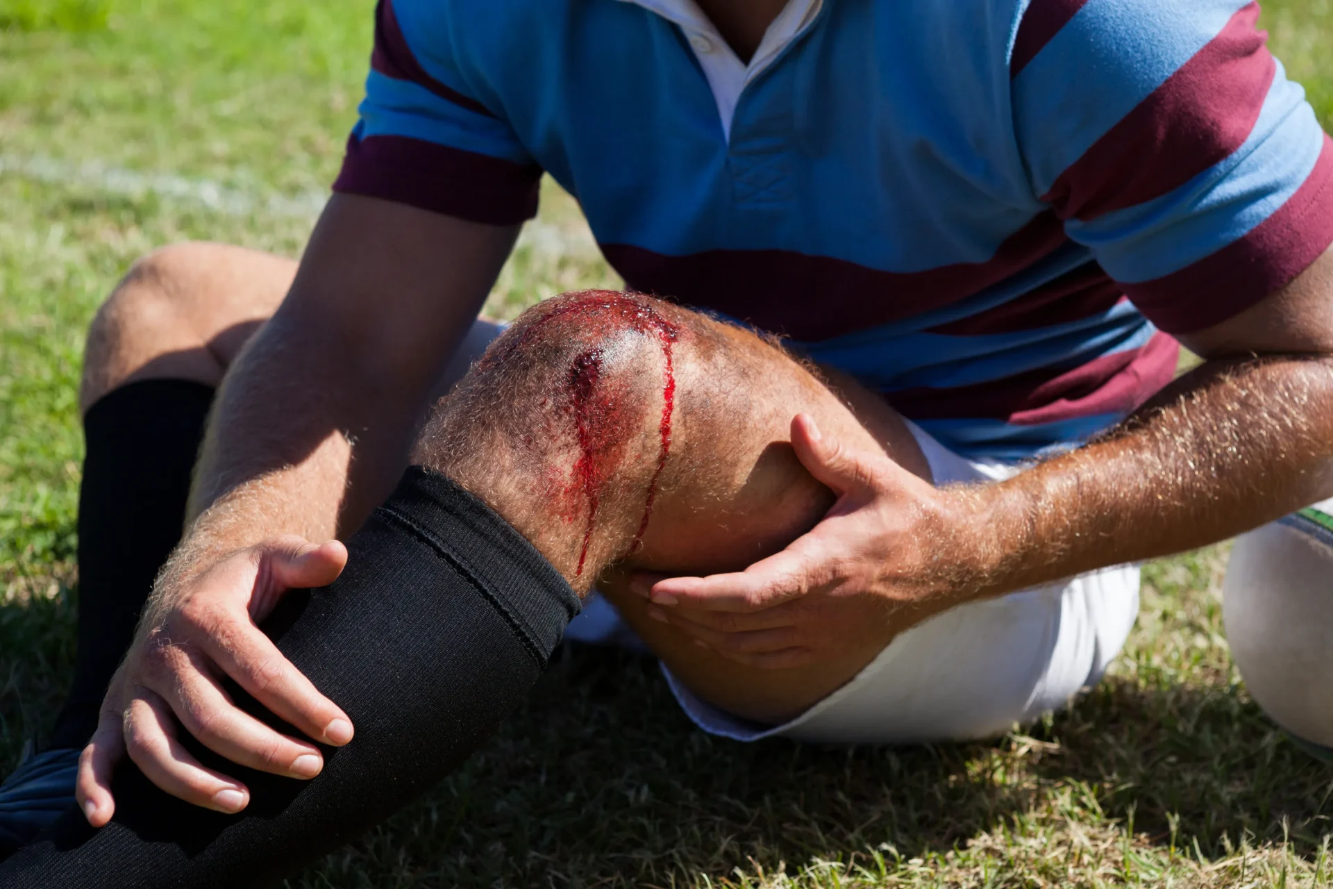Gekneusde knie door voetbal