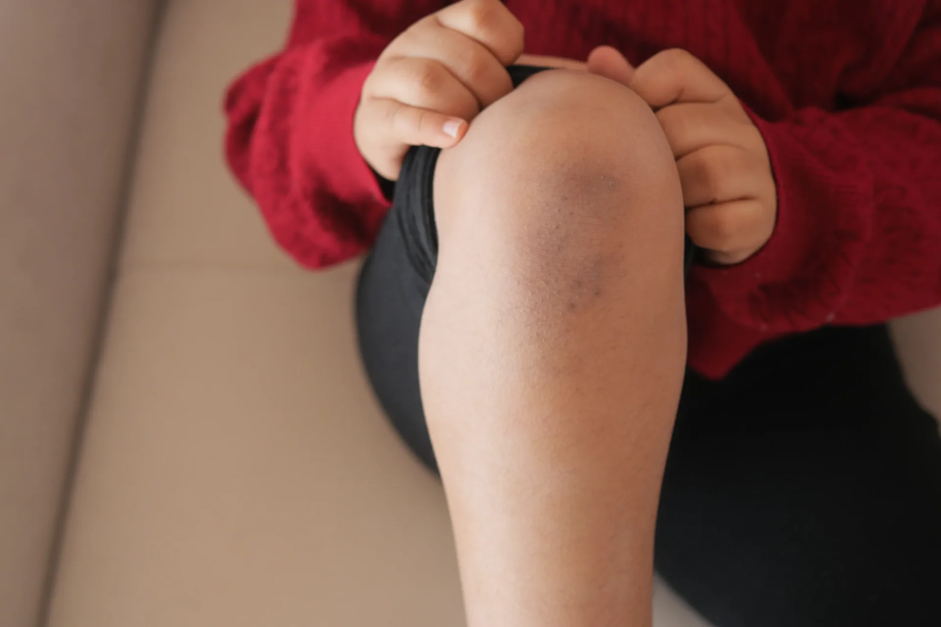 Kind met gekneusde knie na een val