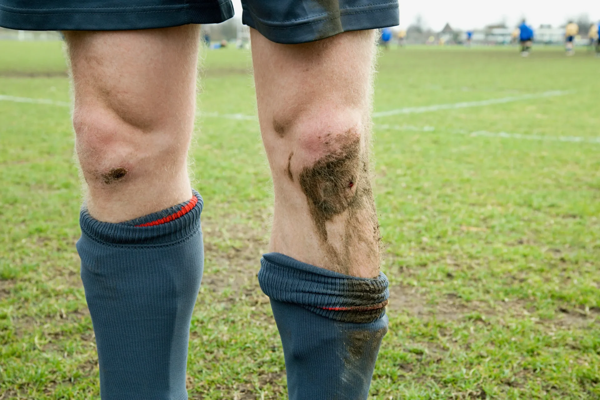 Voetbalknie